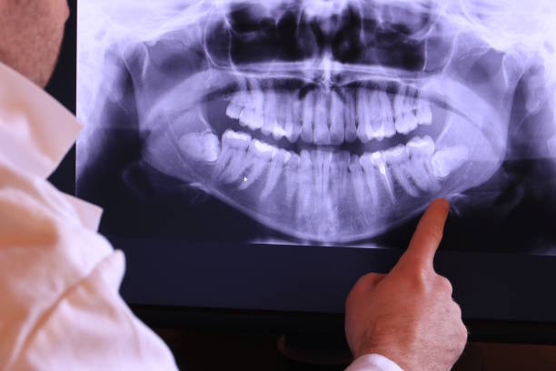 Best Knocked-Out Tooth Emergency  in Union Springs, NY